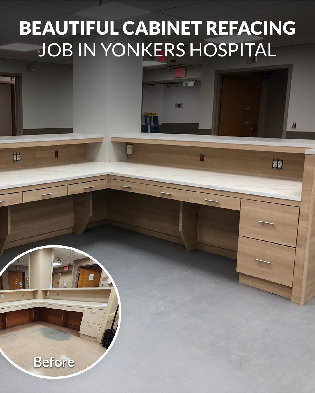 Beautiful Cabinet Refacing Job In Yonkers Hospital